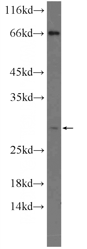 HEK-293 cells were subjected to SDS PAGE followed by western blot with Catalog No:113055(NDFIP1 Antibody) at dilution of 1:300