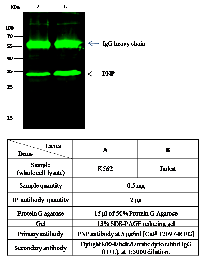 Purine nucleoside phosphorylase / PNP Antibody, Rabbit MAb, Immunoprecipitation