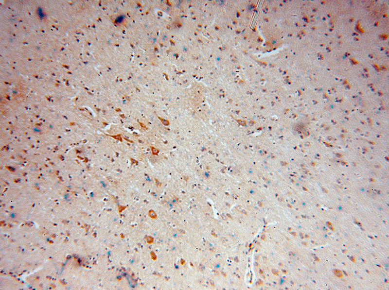 Immunohistochemical of paraffin-embedded human brain using Catalog No:114873(RPL18A antibody) at dilution of 1:100 (under 10x lens)