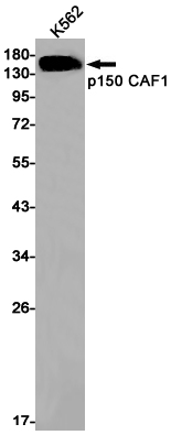 Western blot detection of p150 CAF1 in K562 cell lysates using p150 CAF1 Rabbit pAb(1:1000 diluted).Predicted band size:107kDa.Observed band size:150kDa.