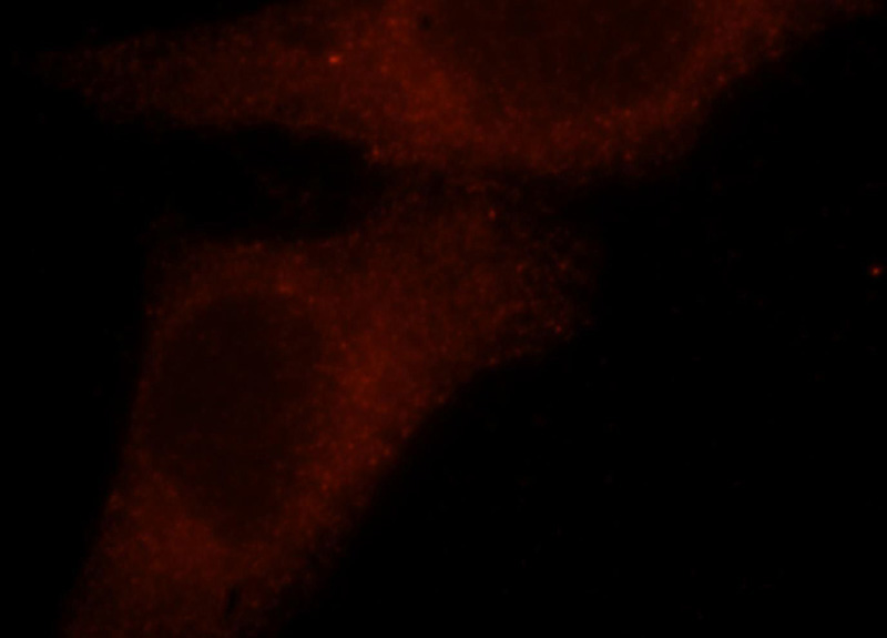 Immunofluorescent analysis of HepG2 cells, using TRIOBP antibody Catalog No:115852 at 1:25 dilution and Rhodamine-labeled goat anti-rabbit IgG (red).