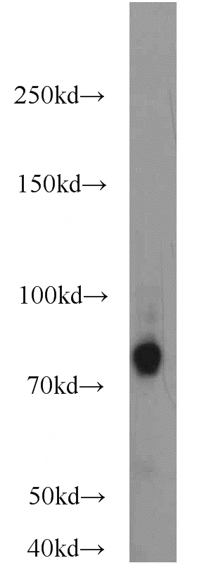 mouse brain tissue were subjected to SDS PAGE followed by western blot with Catalog No:115755(SV2C antibody) at dilution of 1:500