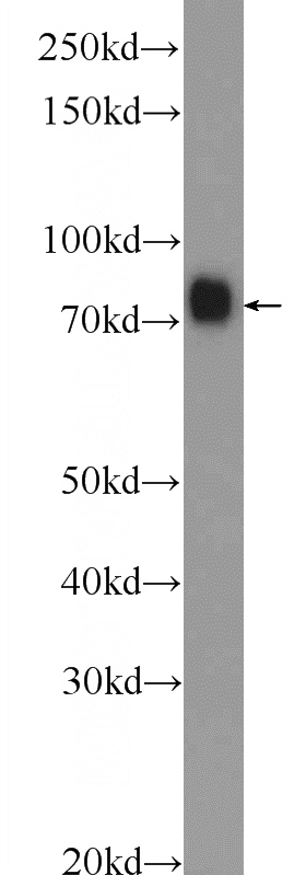human plasma tissue were subjected to SDS PAGE followed by western blot with Catalog No:110427(F2 Antibody) at dilution of 1:30000