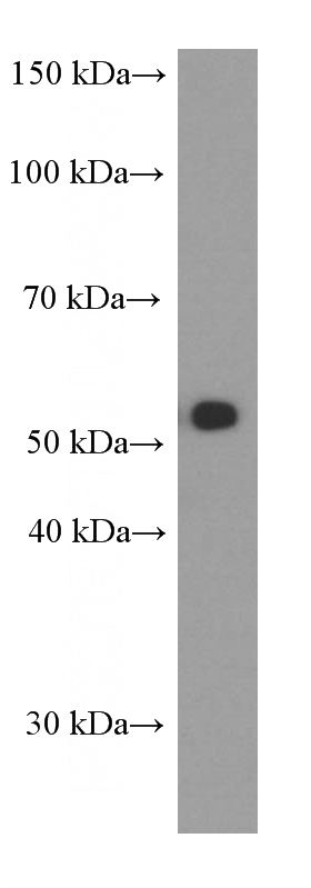 SKOV-3 cells were subjected to SDS PAGE followed by western blot with Catalog No:107138(CD47 Antibody) at dilution of 1:3000