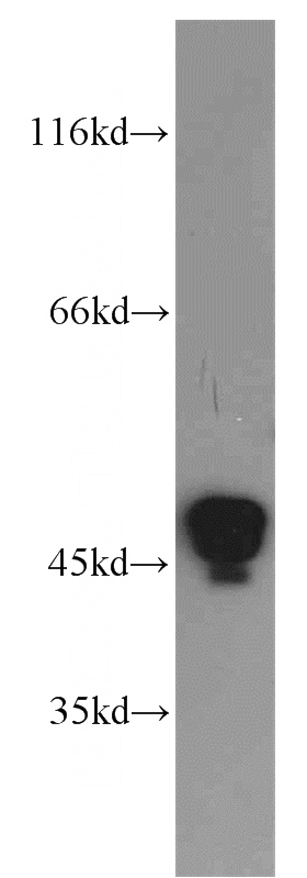 COLO 320 cells were subjected to SDS PAGE followed by western blot with Catalog No:109805(KRT20 antibody) at dilution of 1:1500