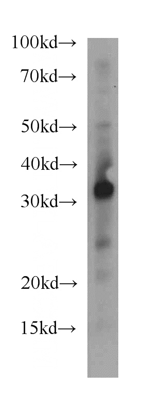 mouse small intestine tissue were subjected to SDS PAGE followed by western blot with Catalog No:115702(STC1 antibody) at dilution of 1:500