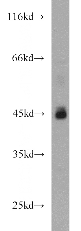 HeLa cells were subjected to SDS PAGE followed by western blot with Catalog No:107759(ADA antibody) at dilution of 1:800