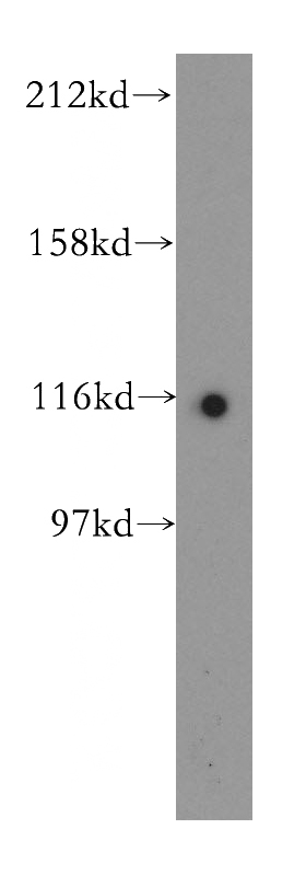 HeLa cells were subjected to SDS PAGE followed by western blot with Catalog No:114060(POP1 antibody) at dilution of 1:500