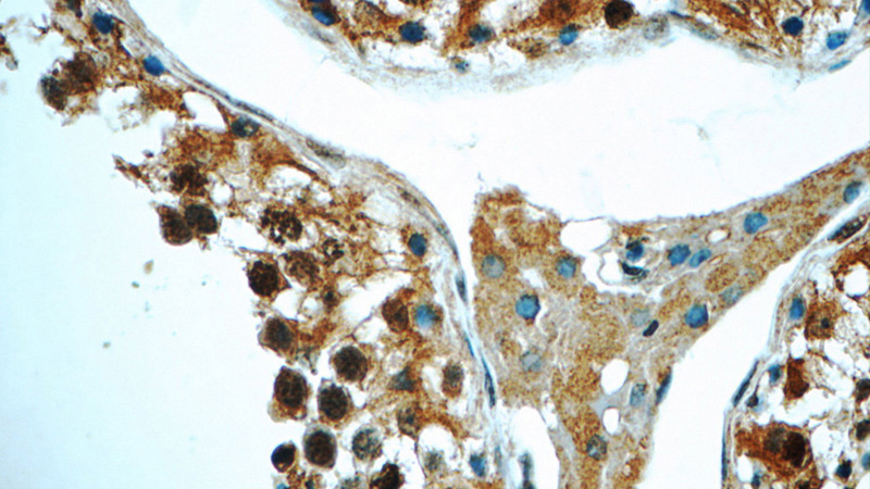 Immunohistochemistry of paraffin-embedded human testis tissue slide using Catalog No:112717(MNS1 Antibody) at dilution of 1:50 (under 40x lens)