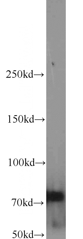 Jurkat cells were subjected to SDS PAGE followed by western blot with Catalog No:111811(INTS9 antibody) at dilution of 1:1000