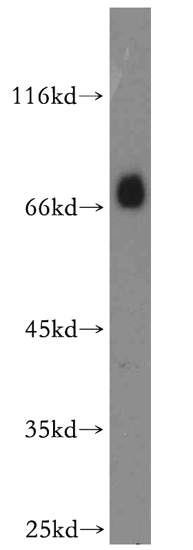 mouse brain tissue were subjected to SDS PAGE followed by western blot with Catalog No:110149(DMD antibody) at dilution of 1:1500