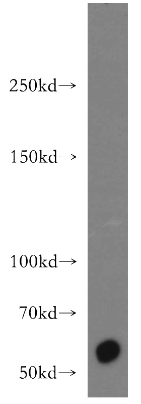 A431 cells were subjected to SDS PAGE followed by western blot with Catalog No:109153(CDH23 antibody) at dilution of 1:300