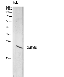 Fig1:; Western blot analysis of hela lysis using CMTM8 antibody.. Secondary antibody（catalog#: HA1001) was diluted at 1:20000