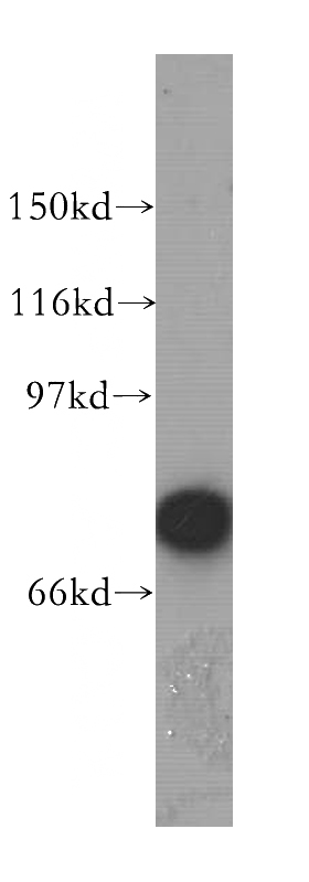 HEK-293 cells were subjected to SDS PAGE followed by western blot with Catalog No:114119(PPEF1 antibody) at dilution of 1:300