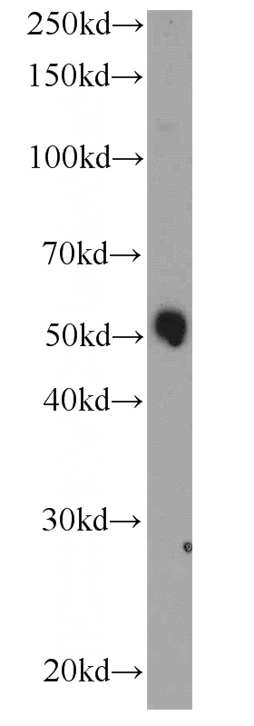 human placenta tissue were subjected to SDS PAGE followed by western blot with Catalog No:110851(GALNTL5 antibody) at dilution of 1:500