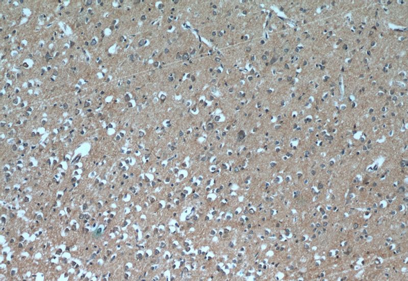 Immunohistochemistry of paraffin-embedded human brain tissue slide using Catalog No:109858(DAOA Antibody) at dilution of 1:50 (under 10x lens)