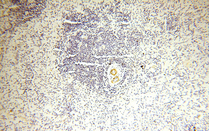 Immunohistochemical of paraffin-embedded human spleen using Catalog No:110930(GDPD5 antibody) at dilution of 1:50 (under 10x lens)