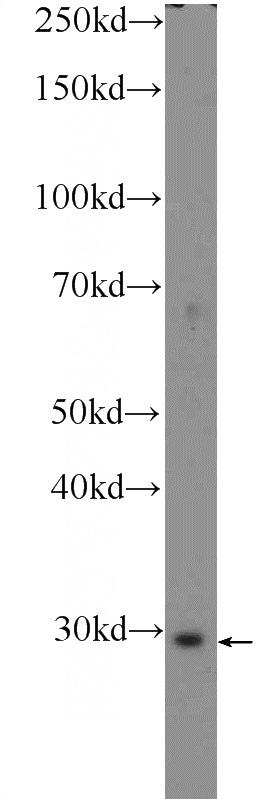 MCF-7 cells were subjected to SDS PAGE followed by western blot with Catalog No:108077(ANKRD49 Antibody) at dilution of 1:600