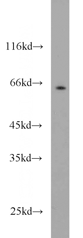 mouse brain tissue were subjected to SDS PAGE followed by western blot with Catalog No:113755(PCTK1 antibody) at dilution of 1:600