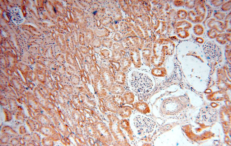 Immunohistochemical of paraffin-embedded human kidney using Catalog No:112411(LYPLAL1 antibody) at dilution of 1:50 (under 10x lens)