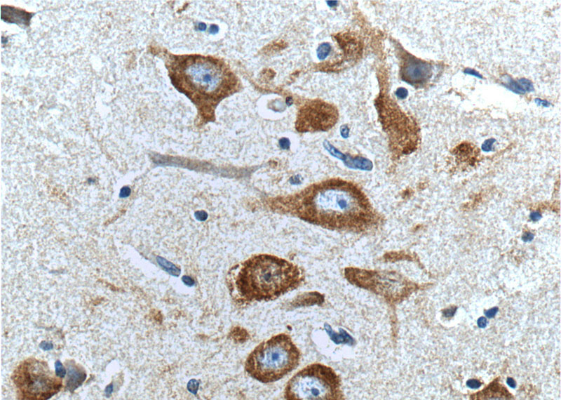 Immunohistochemistry of paraffin-embedded human brain tissue slide using (Peripherin Antibody) at dilution of 1:100 (under 40x lens).