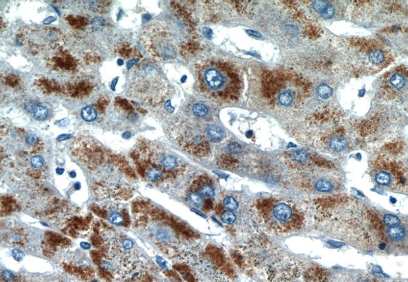 Immunohistochemistry of paraffin-embedded human hepatocirrhosis tissue slide using Catalog No:114349(PXMP2 Antibody) at dilution of 1:50 (under 40x lens)