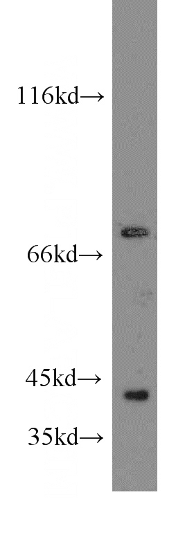human brain tissue were subjected to SDS PAGE followed by western blot with Catalog No:109369(COG6 antibody) at dilution of 1:300