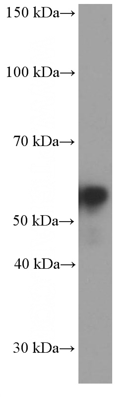 rat brain tissue were subjected to SDS PAGE followed by western blot with Catalog No:107463(Peripherin Antibody) at dilution of 1:3000