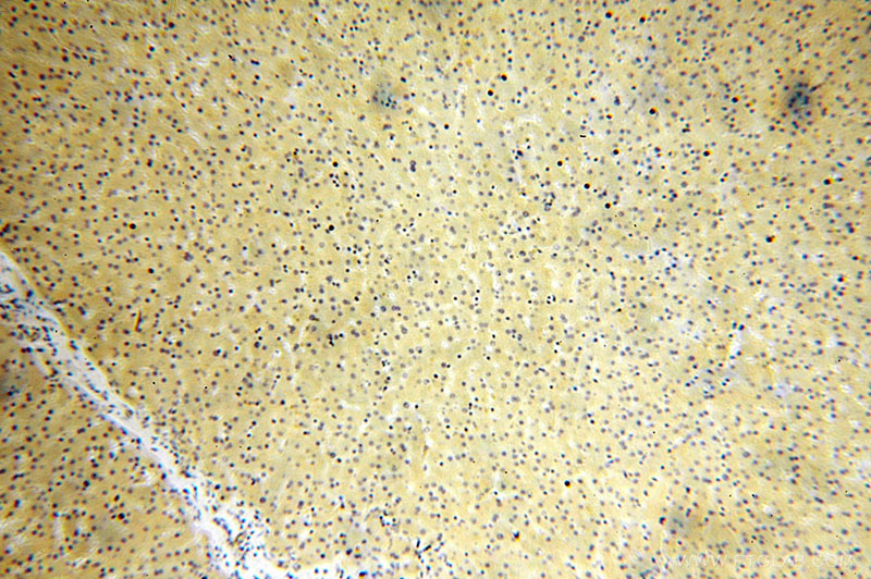 Immunohistochemical of paraffin-embedded human liver using Catalog No:107953(AARS antibody) at dilution of 1:100 (under 10x lens)