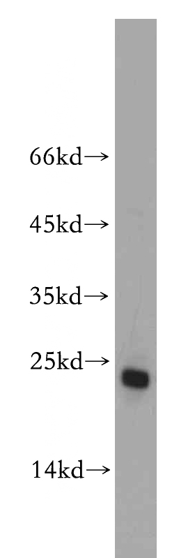 HeLa cells were subjected to SDS PAGE followed by western blot with Catalog No:114156(PPPDE1 antibody) at dilution of 1:500
