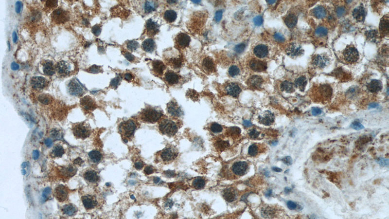 Immunohistochemistry of paraffin-embedded human testis tissue slide using Catalog No:110080(DNAH14 Antibody) at dilution of 1:50 (under 40x lens)