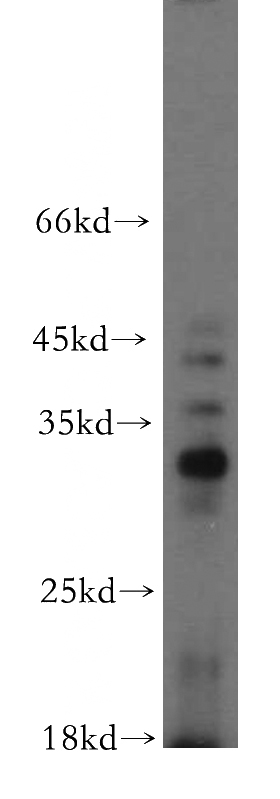 PC-3 cells were subjected to SDS PAGE followed by western blot with Catalog No:108665(C14orf94 antibody) at dilution of 1:500