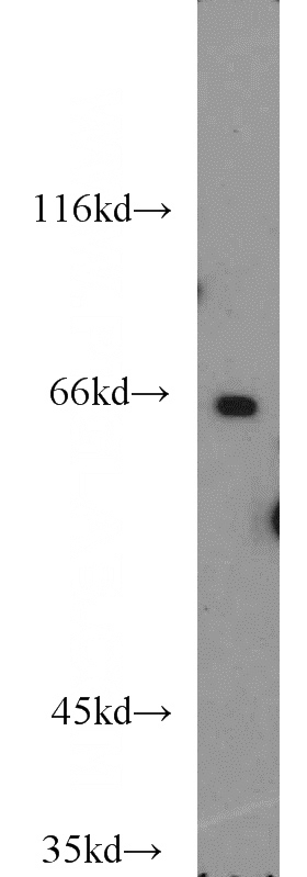 PC-3 cells were subjected to SDS PAGE followed by western blot with Catalog No:113462(OATP14 antibody) at dilution of 1:1000