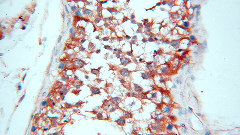 Immunohistochemical of paraffin-embedded human testis using Catalog No:107729(ACBD3 antibody) at dilution of 1:100 (under 40x lens)