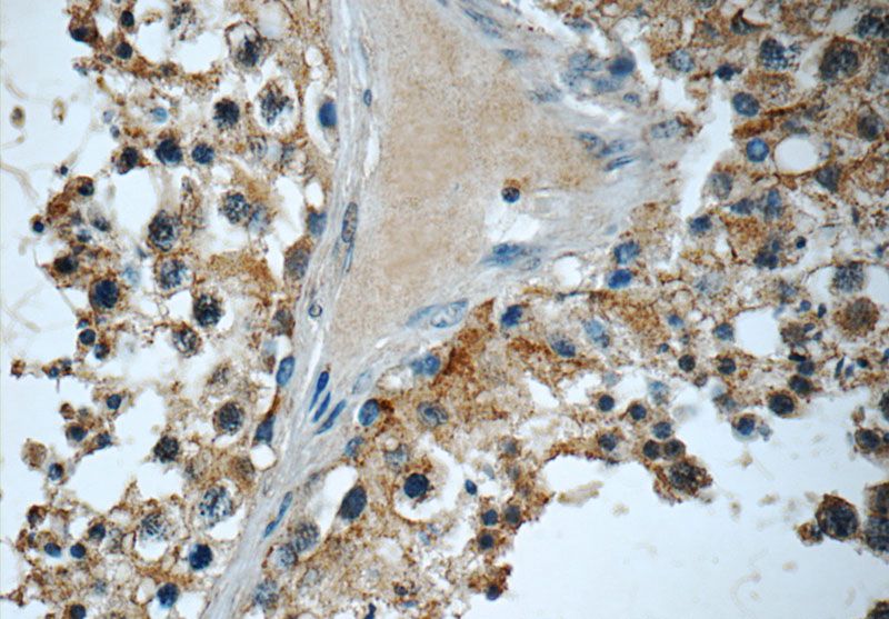 Immunohistochemistry of paraffin-embedded human testis tissue slide using Catalog No:110235(EMB Antibody) at dilution of 1:50 (under 40x lens)