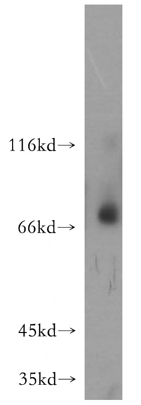 HepG2 cells were subjected to SDS PAGE followed by western blot with Catalog No:112708(MMP8 antibody) at dilution of 1:500