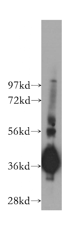 human brain tissue were subjected to SDS PAGE followed by western blot with Catalog No:110998(GNB4 antibody) at dilution of 1:500