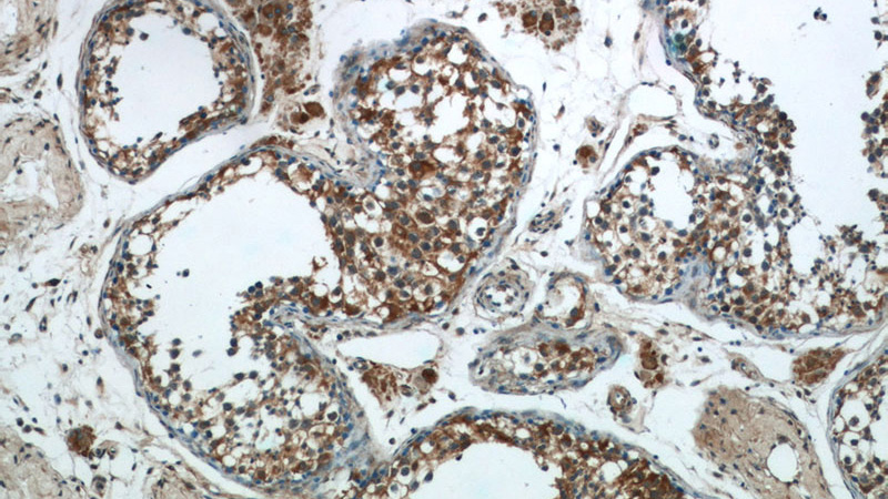 Immunohistochemistry of paraffin-embedded human testis tissue slide using Catalog No:114338(PUMA Antibody) at dilution of 1:200 (under 10x lens)