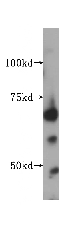 human kidney tissue were subjected to SDS PAGE followed by western blot with Catalog No:111680(IGF2BP2 antibody) at dilution of 1:1000