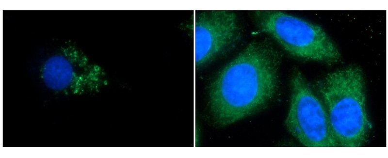 Immunofluorescent analysis of Chloroquine treated HepG2 cells and HepG2 cells using Catalog No:112164(LC3 Antibody) at dilution of 1:50 and Alexa Fluor 488-congugated AffiniPure Goat Anti-Rabbit IgG(H+L).
