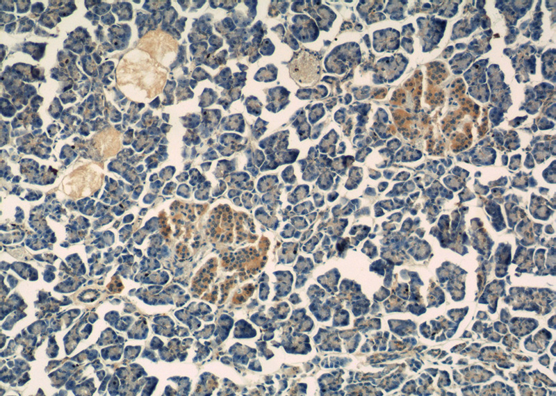Immunohistochemistry of paraffin-embedded human pancreas tissue slide using Catalog No:107273(IDH1 Antibody) at dilution of 1:200 (under 10x lens)