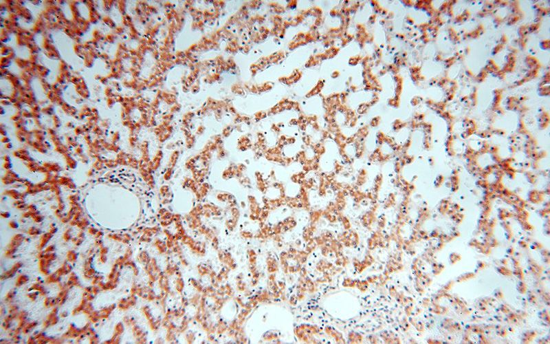 Immunohistochemical of paraffin-embedded human liver using Catalog No:113895(PIGO antibody) at dilution of 1:100 (under 10x lens)