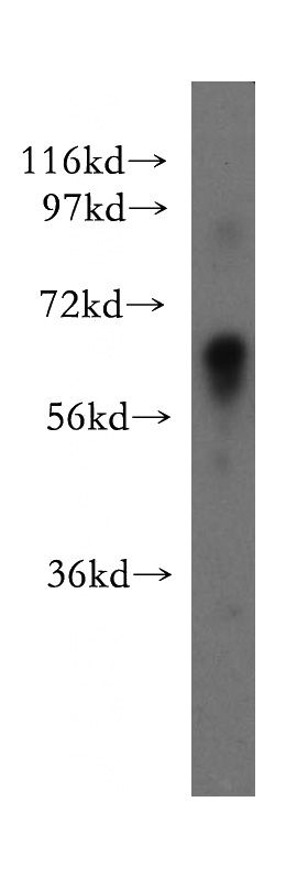 Jurkat cells were subjected to SDS PAGE followed by western blot with Catalog No:111089(GPC3 antibody) at dilution of 1:500
