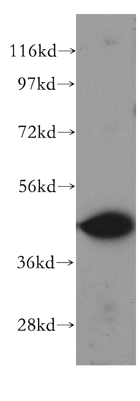 mouse skeletal muscle tissue were subjected to SDS PAGE followed by western blot with Catalog No:116977(WWOX antibody) at dilution of 1:300