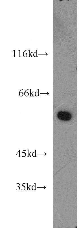 mouse kidney tissue were subjected to SDS PAGE followed by western blot with Catalog No:116619(UNC5D-Specific antibody) at dilution of 1:500