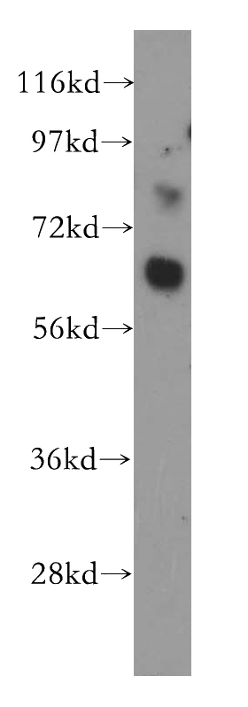 HEK-293 cells were subjected to SDS PAGE followed by western blot with Catalog No:112339(LRRTM1 antibody) at dilution of 1:400