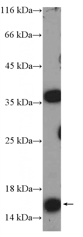 COLO 320 cells were subjected to SDS PAGE followed by western blot with Catalog No:112581(MED10 Antibody) at dilution of 1:300