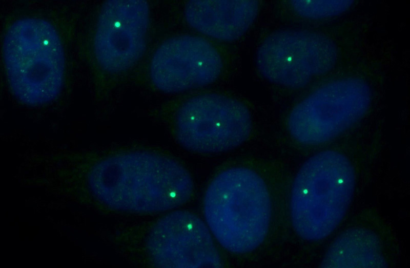 Immunofluorescent analysis of HepG2 cells using Catalog No:109372(COIL Antibody) at dilution of 1:50 and Alexa Fluor 488-congugated AffiniPure Goat Anti-Rabbit IgG(H+L)