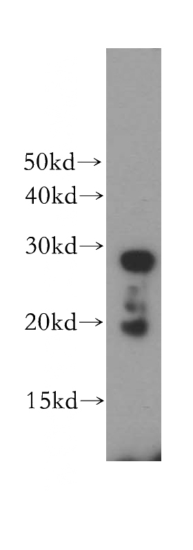 human liver tissue were subjected to SDS PAGE followed by western blot with Catalog No:114433(RAB34 antibody) at dilution of 1:300