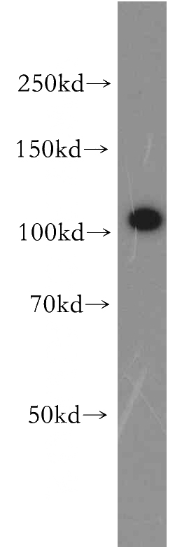 human brain tissue were subjected to SDS PAGE followed by western blot with Catalog No:116770(VPS11 antibody) at dilution of 1:500